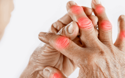 Homepage 17 C4 Muscle Gel: CBD for Inflammation and Pain Targeted Relief